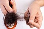 ریزش مو تا چند تار طبیعی است؟