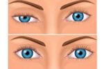 تیک عصبی چشم را چگونه کنترل کنیم؟