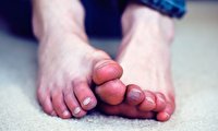 پای مردابی چگونه ایجاد و درمان می شود؟