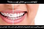 چرا ارتودنسی دندان؟