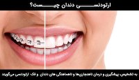 چرا ارتودنسی دندان؟