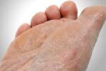 ۸ روش برای از بین بردن پوست مرده کف پا