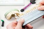 راهنمای جامع پروتزهای نوین و اوردنچر؛ از تحول در دندانسازی تا بازیابی لبخند طبیعی