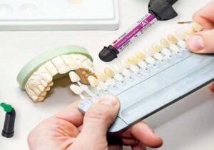 راهنمای جامع پروتزهای نوین و اوردنچر؛ از تحول در دندانسازی تا بازیابی لبخند طبیعی
